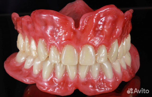 Зубной Протез