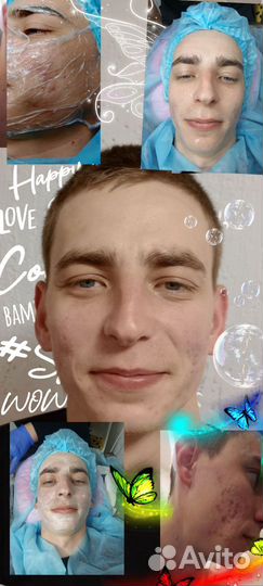 Чистки+ пилинги+ маски