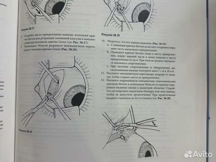 Офтальмохирургия