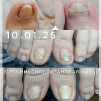 Подолог, Чебоксары