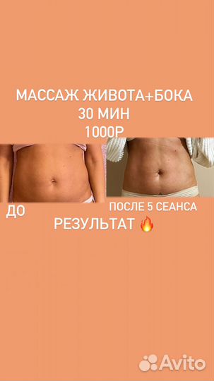 Массаж