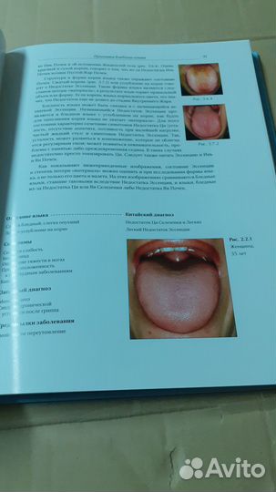 Атлас Китайской диагностики по языку