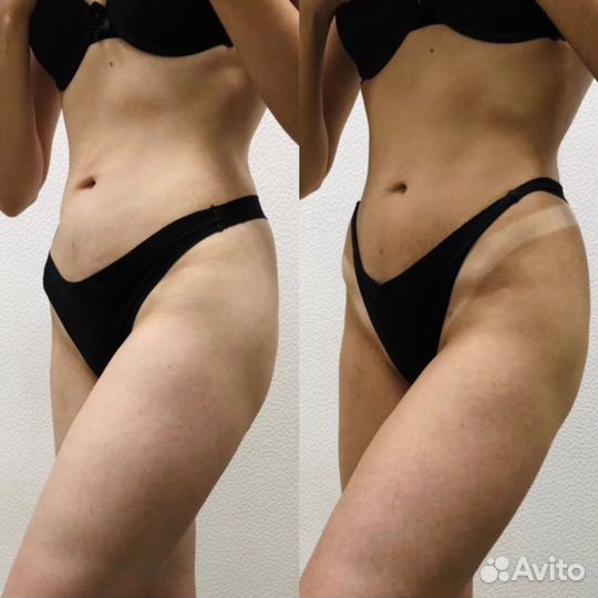 Эко-загар (моментальный загар)