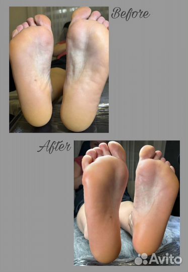 Smart-педикюр