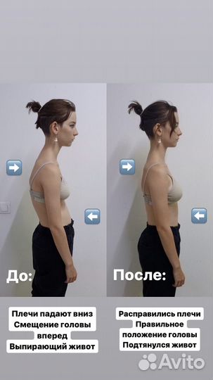 Кинезиолог. ЛФК. Массаж. Коррекция осанки