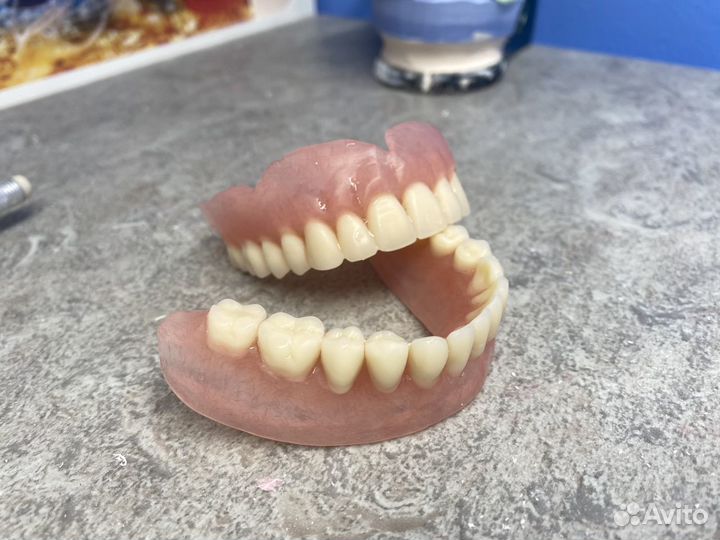 Срочный ремонт зубных протезов В Москве