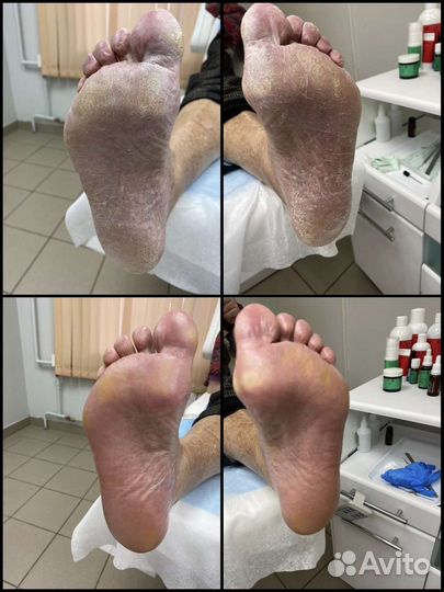 Услуги подолога