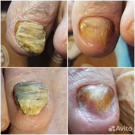 Подология, smart педикюр, моделирование