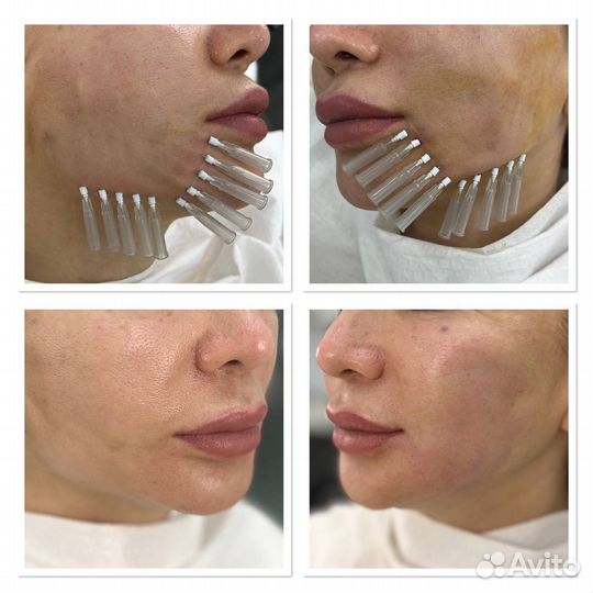 Модель на нити