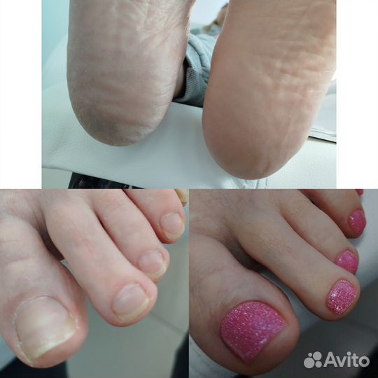 Педикюр