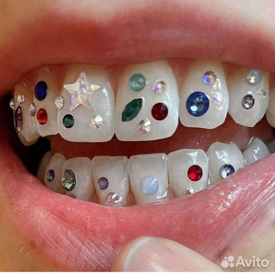 Установка скайсов,твинклов