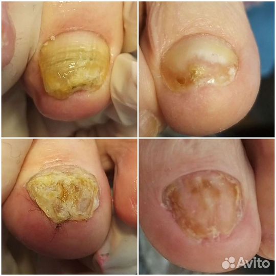 Подология, smart педикюр, моделирование