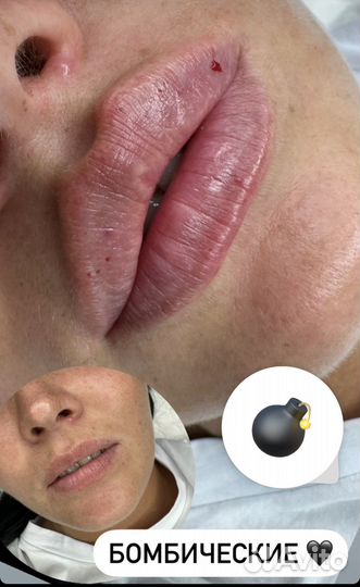 Услуги косметолога