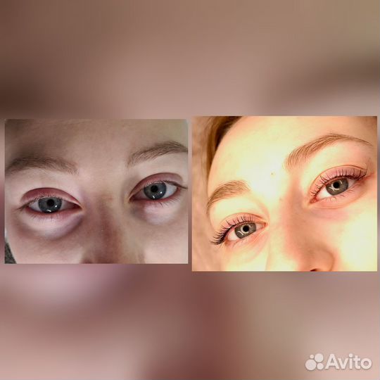 Обучение по ламинированию ресниц