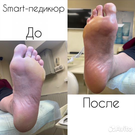 Аппаратный маникюр