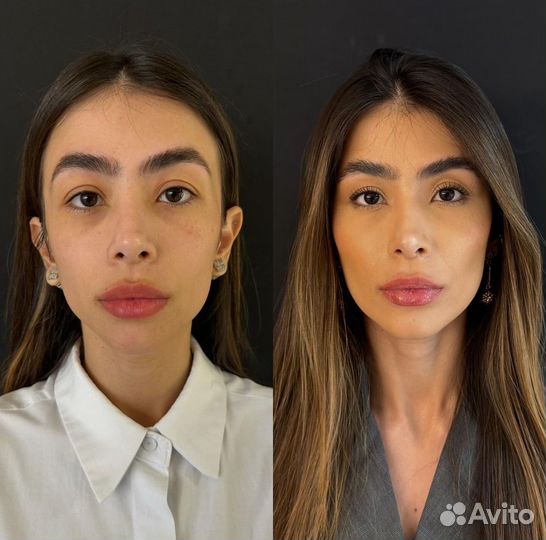 Full Face / Лицо под ключ