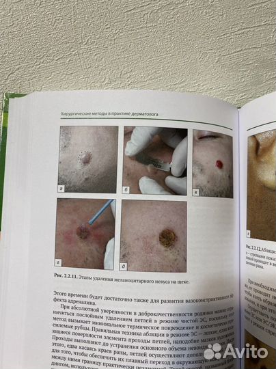 Хирургические методы в практике дерматолога