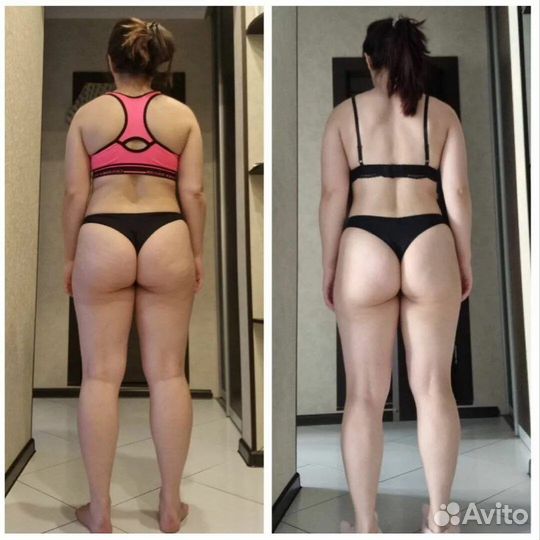 Плоский живот, бразильская попа, EMS sculpt c RF