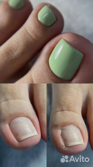 Смарт (аппаратный) педикюр