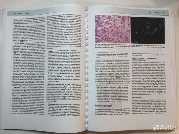 Основы патологии заболеваний по роббинсу и котрану