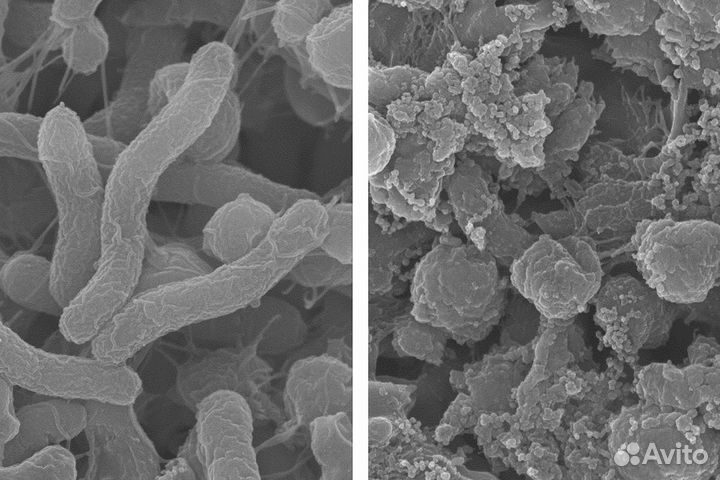 Пациенты на терапевтию