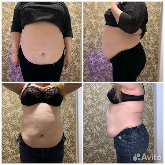 Аппаратная коррекция фигуры