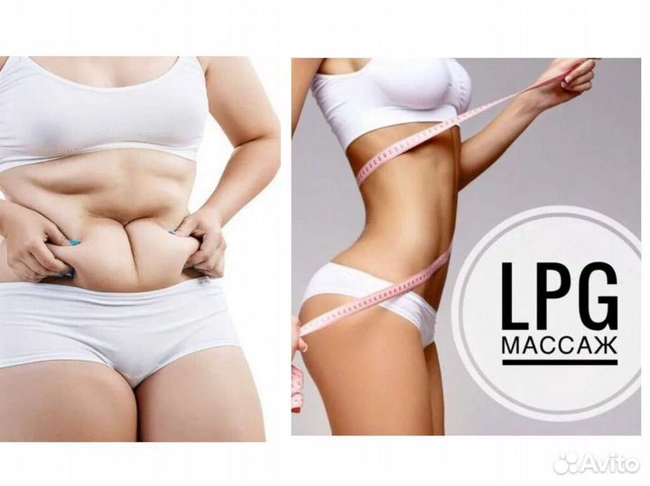 Lpg массаж лпдж