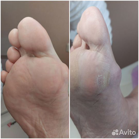 Подолог, педикюр