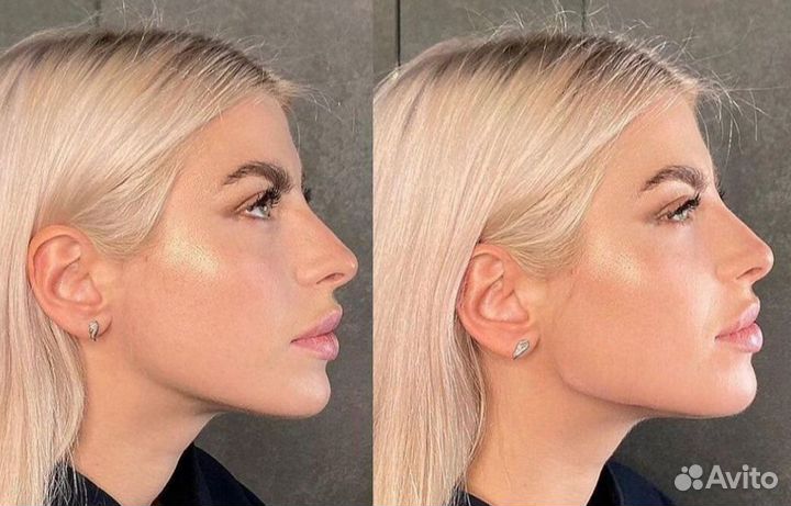 Косметолог/Full Face/Ботокс