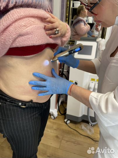 Электрокаогуляция новообразований на лице и теле