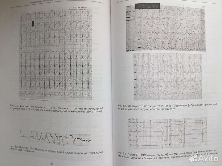 Барсуков Синкопальные состояния