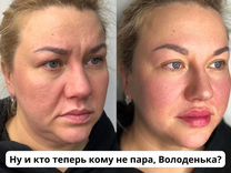 Контурная пластика Омоложение Подтяжка лица