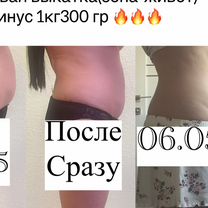 Коррекция фигуры,липолитики, Курган