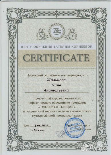 Электроэпиляция