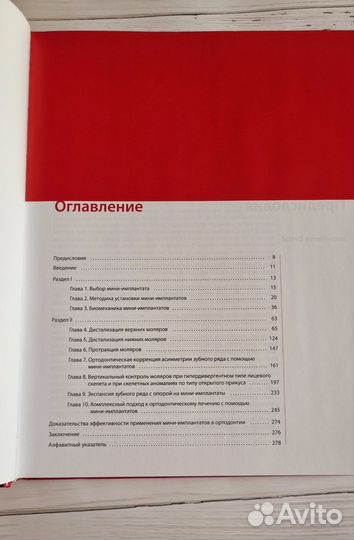 Мини-имплантаты Скандер Эллуз,Франсуа Дарке