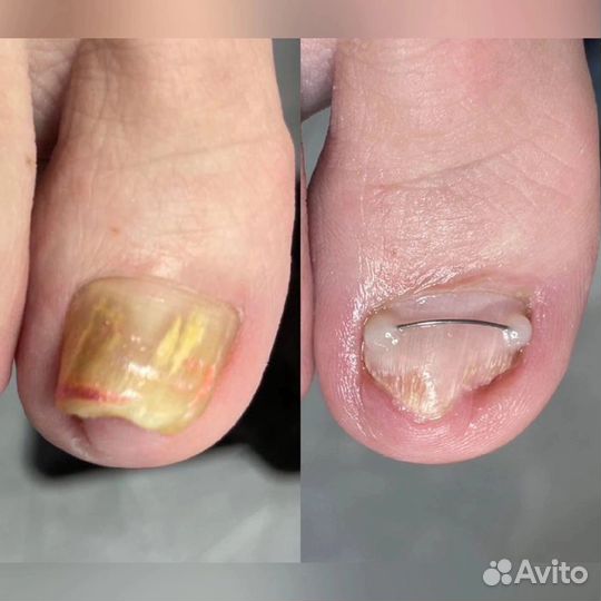 Маникюр педикюр наращивание ногтей