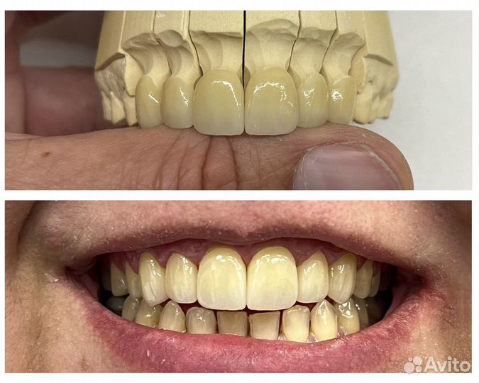 Зубной техник керамист