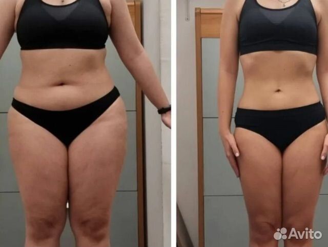 Кавитация коррекция фигуры