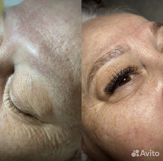 Наращивание ресниц