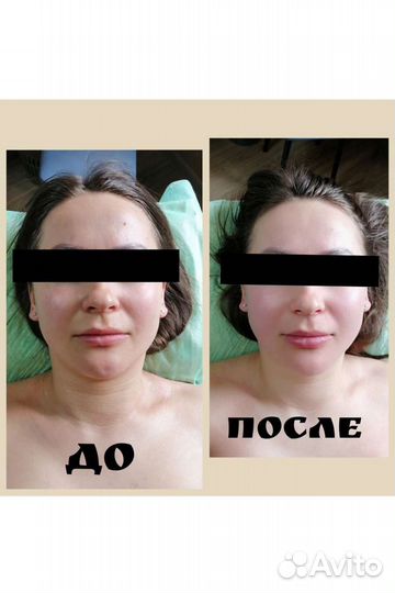 Массаж тела и лица, шугаринг, аппаратные пр - ры