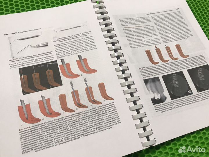 Эндодонтия С. Коэн