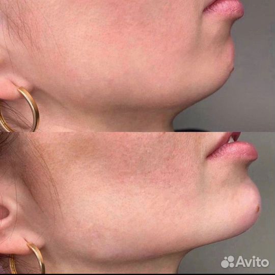 Услуги косметолога full face