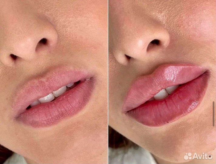 Услуги косметолога