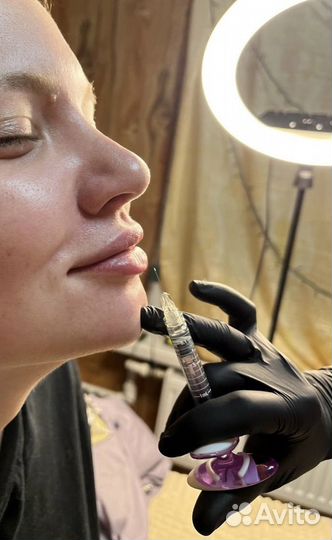 Увеличения губ/ косметолог
