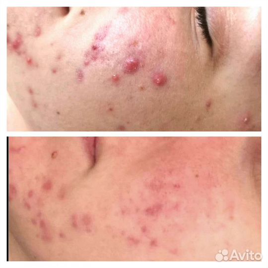 Услуги косметолога