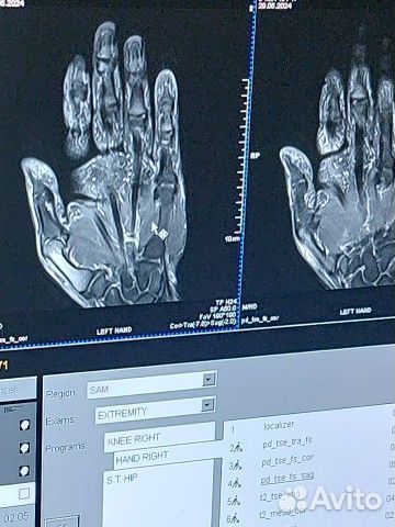 Рентгенолаборант мрт