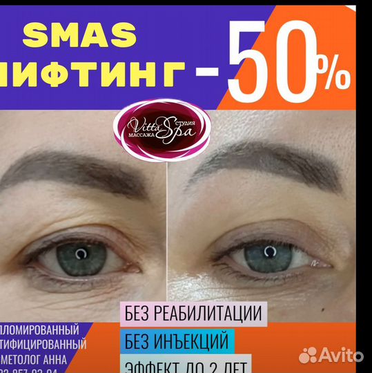 Безоперационная блефаропластика век