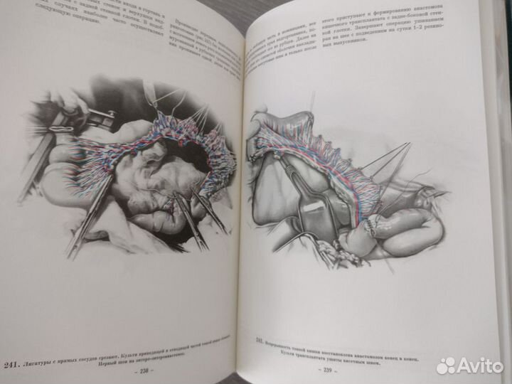 Книга по медицине атлас грудной хирургии 2 тома