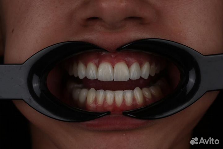 Зубной техник Изготовление Циркон Сотрудничество