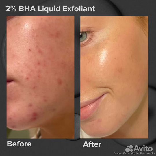 Paula's choice Salicylic Acid. 30 ml